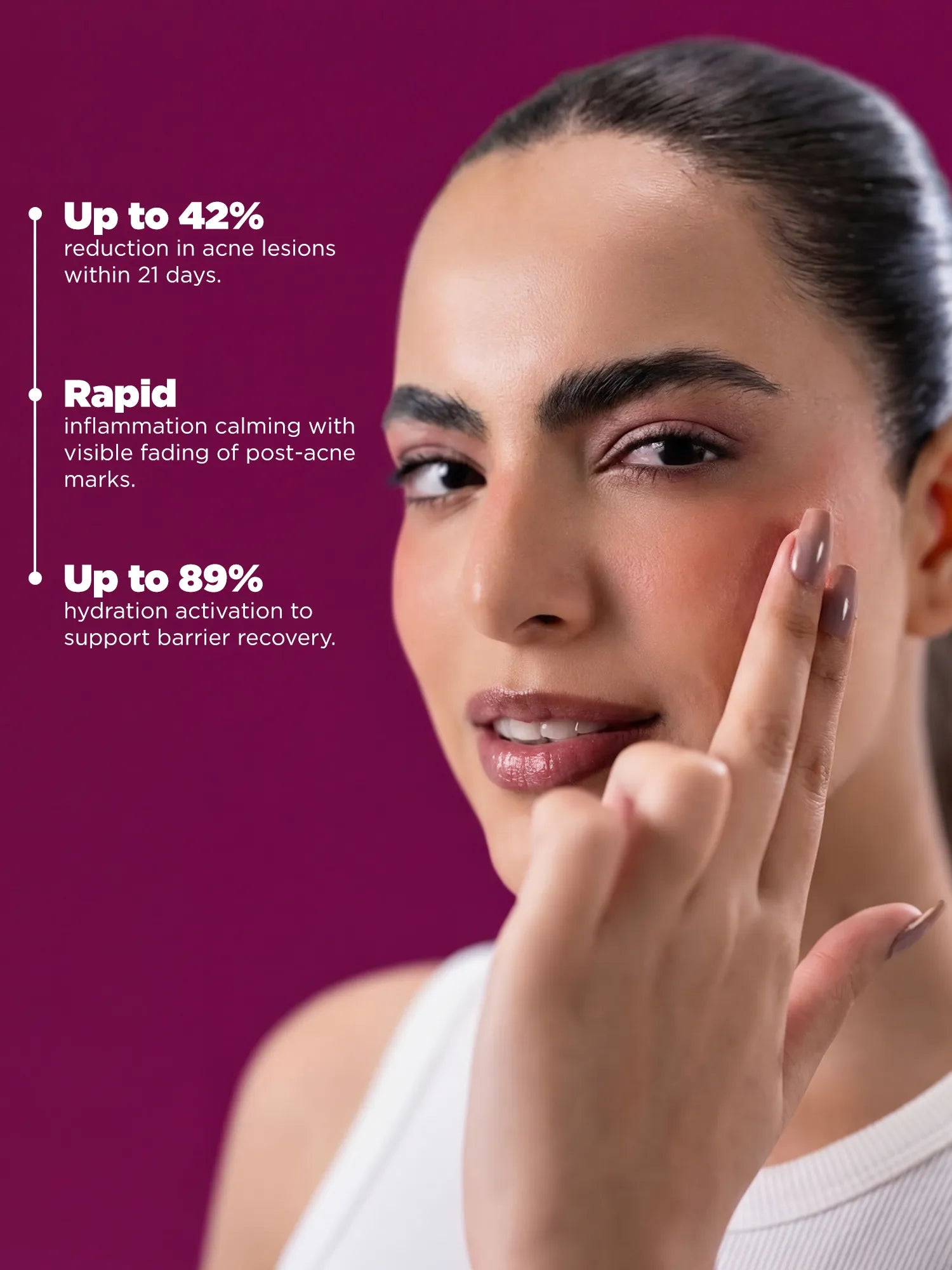 Anti acne serum formulated to reduce breakouts, calm visible redness and support skin barrier recovery for clearer, balanced skin.
