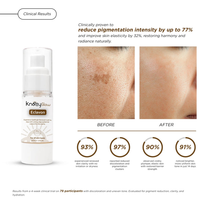 KnottyGlow Eclavon serum to treat pigmentation, brighten skin tone, and enhance overall radiance