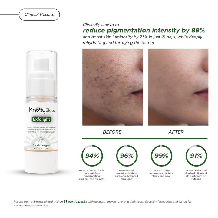 Exfolight skin brightening serum for Pakistani skin that corrects pigmentation, evens tone, and brightens dull skin