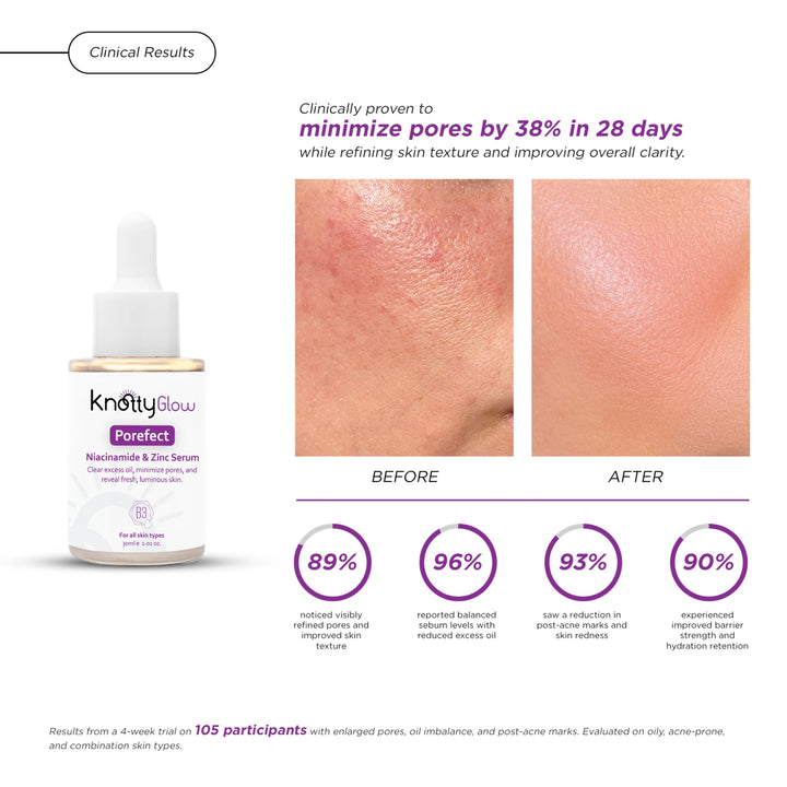 Visible results on Pakistani skin as an oil-balancing serum reduces shine, controls excess sebum, and smooths complexion