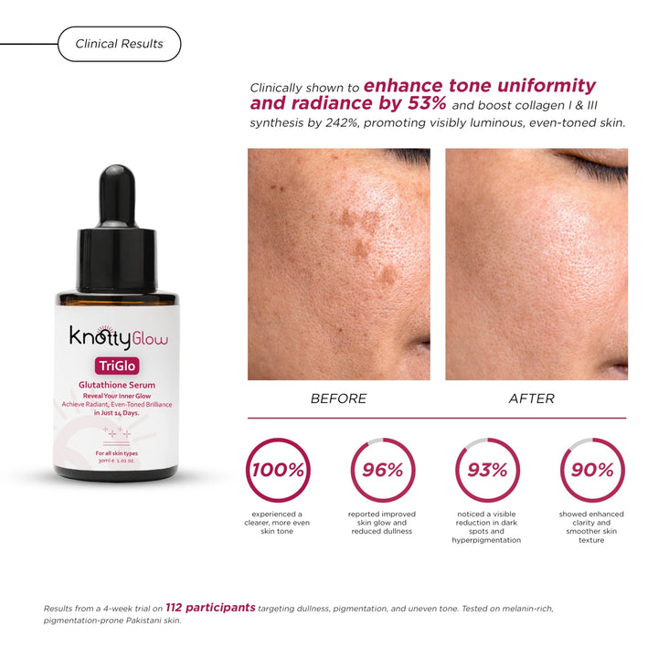TriGlo Glutathione Serum results on Pakistani skin with firmer skin, improved elasticity, radiant glow and even toneTriGlo Glutathione Serum results on Pakistani skin with firmer skin, improved elasticity, radiant glow and even tone